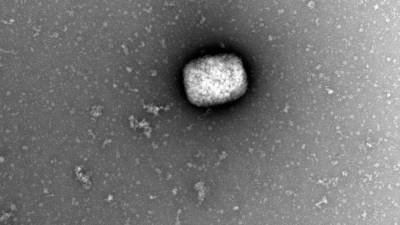 Partículas de la viruela del mono vistas en un microscópio. Foto: EFE