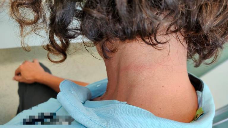 $!La marca de la cinta en el cuello de la trabajadora de Mas d’Enric. Foto: cedida