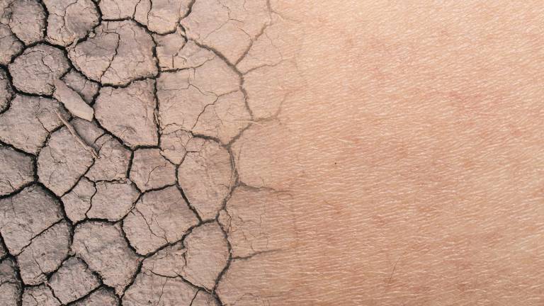 S’ha de tenir especialment cura i ficar-li molta atenció a la quantitat de sol que prenen els nens petits. Foto: Getty Images